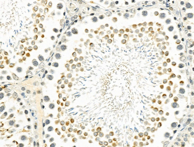 ZNF426 Antibody in Immunohistochemistry (Paraffin) (IHC (P))