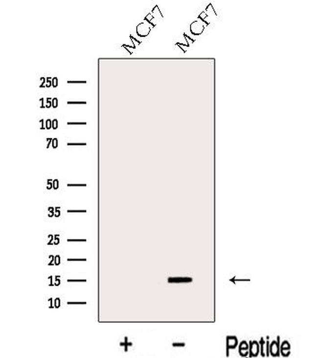 LSM4 Antibody in Western Blot (WB)