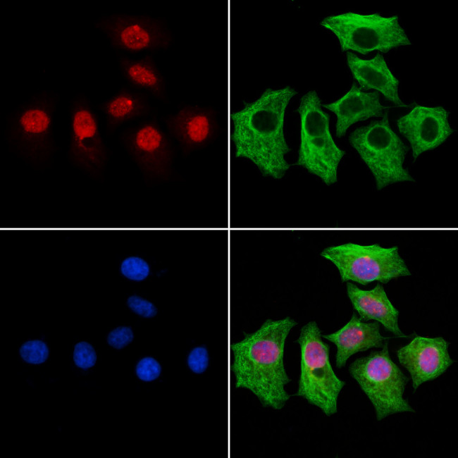 MED10 Antibody in Immunocytochemistry (ICC/IF)