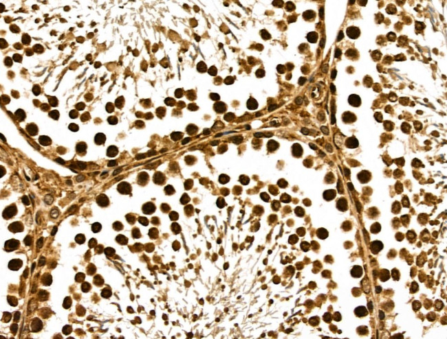 METTL6 Antibody in Immunohistochemistry (Paraffin) (IHC (P))