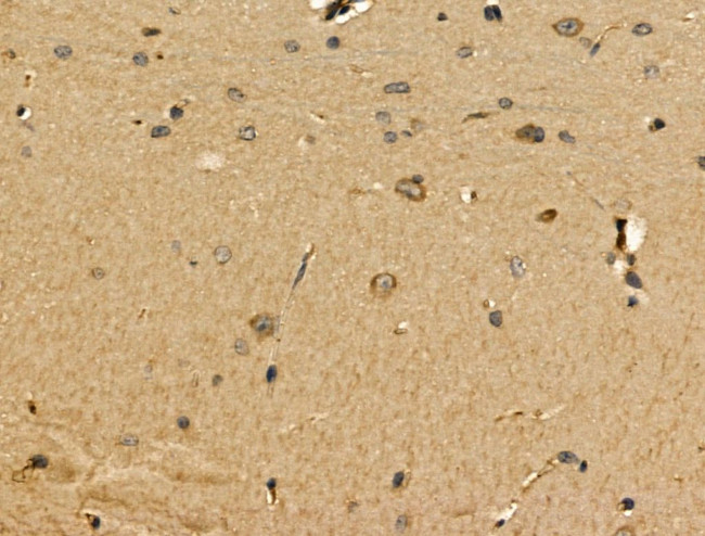 MGAT5B Antibody in Immunohistochemistry (Paraffin) (IHC (P))