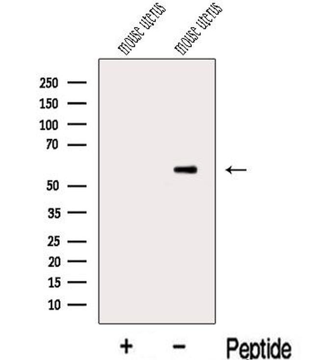 MIER3 Antibody in Western Blot (WB)