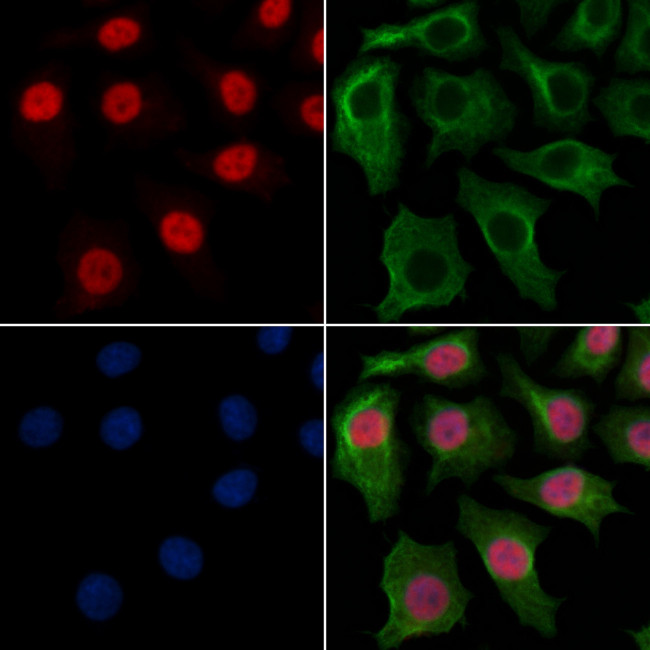 MYEOV2 Antibody in Immunocytochemistry (ICC/IF)