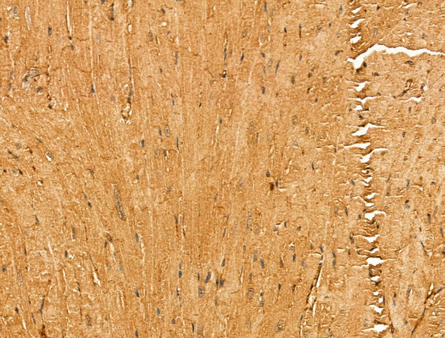 MYOM1 Antibody in Immunohistochemistry (Paraffin) (IHC (P))