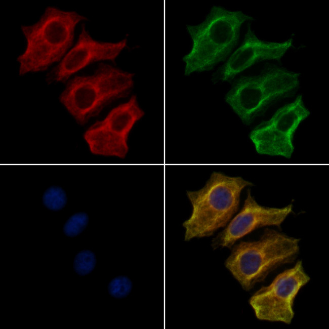 Myotilin Antibody in Immunocytochemistry (ICC/IF)