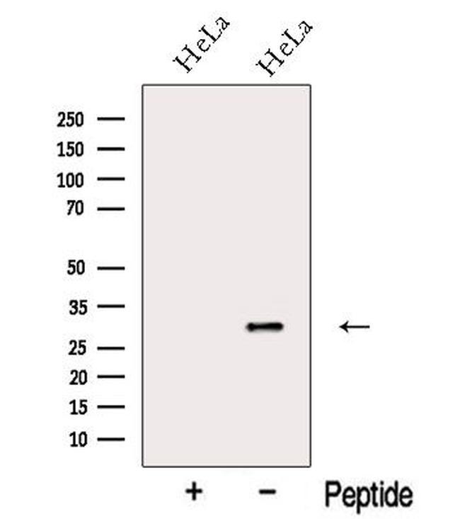NIP30 Antibody in Western Blot (WB)