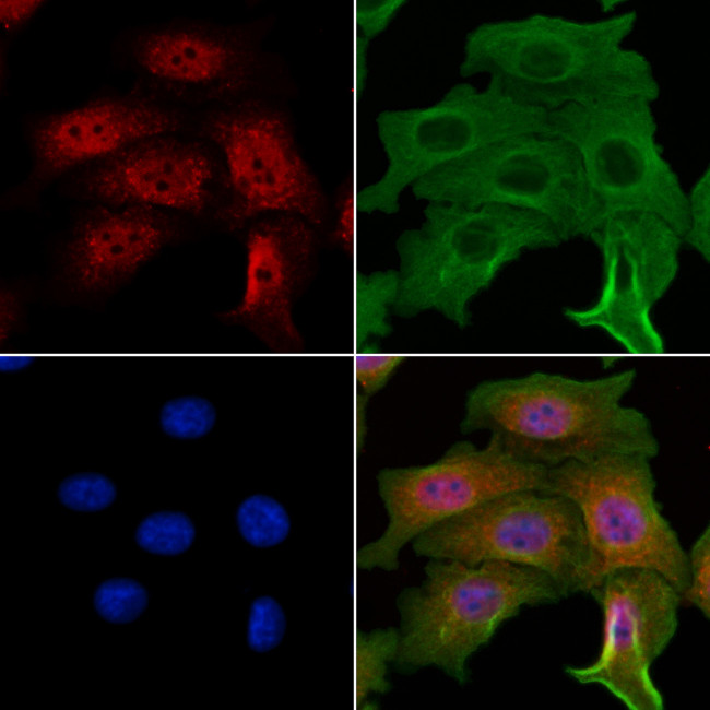 NME5 Antibody in Immunocytochemistry (ICC/IF)