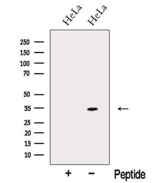 NMRAL1 Antibody in Western Blot (WB)