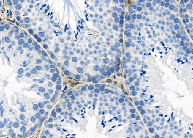 NBPF4 Antibody in Immunohistochemistry (Paraffin) (IHC (P))