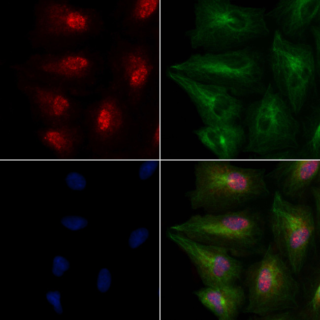 PSPC1 Antibody in Immunocytochemistry (ICC/IF)