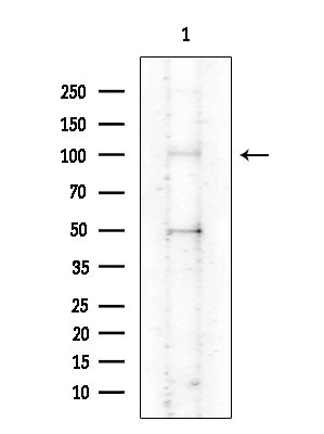 ATP12A Antibody in Western Blot (WB)