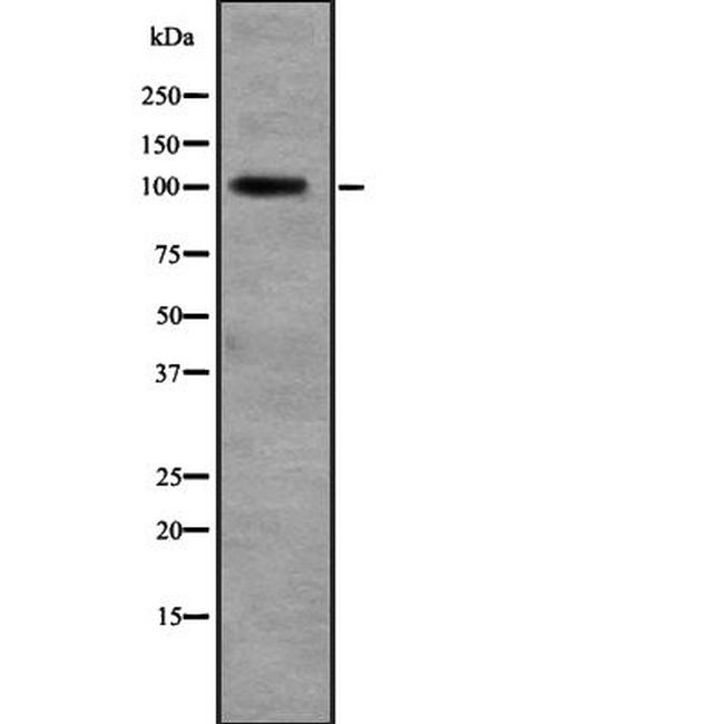 RALGDS Antibody in Western Blot (WB)