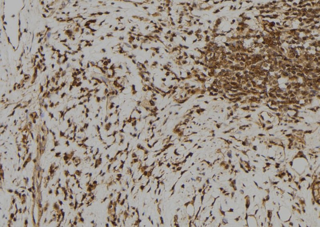 RFPL1 Antibody in Immunohistochemistry (Paraffin) (IHC (P))