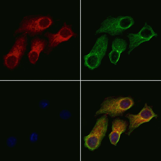 RIOK2 Antibody in Immunocytochemistry (ICC/IF)