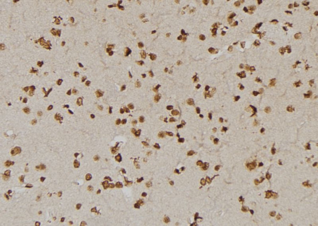 USP1 Antibody in Immunohistochemistry (Paraffin) (IHC (P))