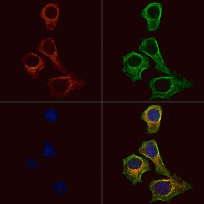 UBE2D3 Antibody in Immunocytochemistry (ICC/IF)