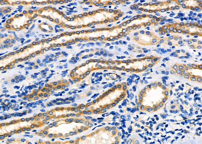 PPP1R13B Antibody in Immunohistochemistry (Paraffin) (IHC (P))