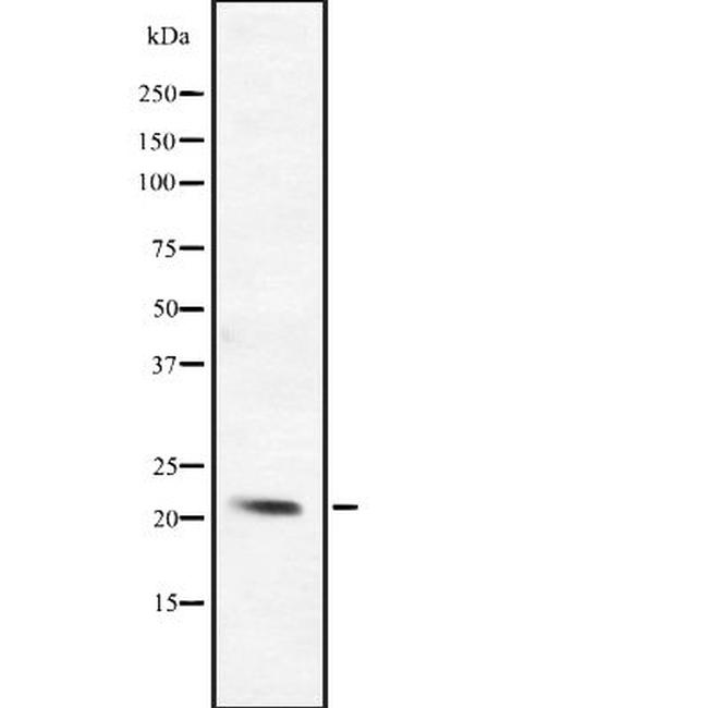 BCL2L10 Antibody in Western Blot (WB)
