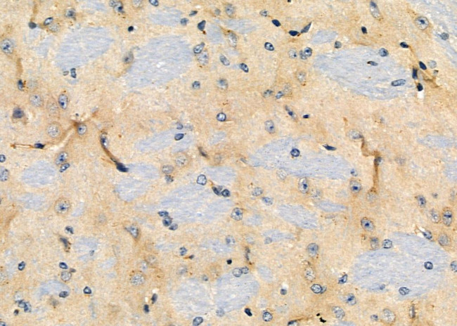 CDH12 Antibody in Immunohistochemistry (Paraffin) (IHC (P))