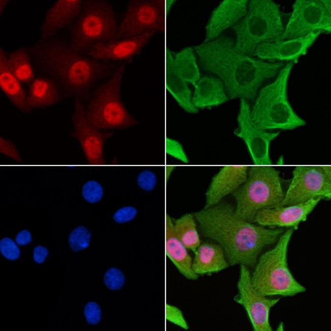 CENPL Antibody in Immunocytochemistry (ICC/IF)