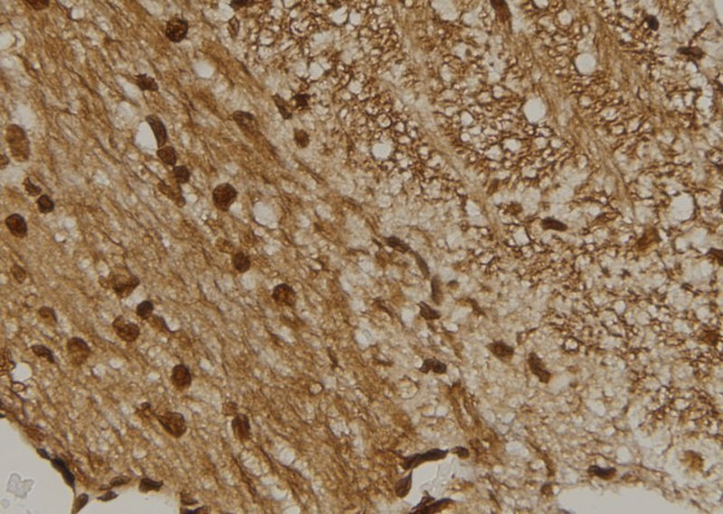 CENPM Antibody in Immunohistochemistry (Paraffin) (IHC (P))