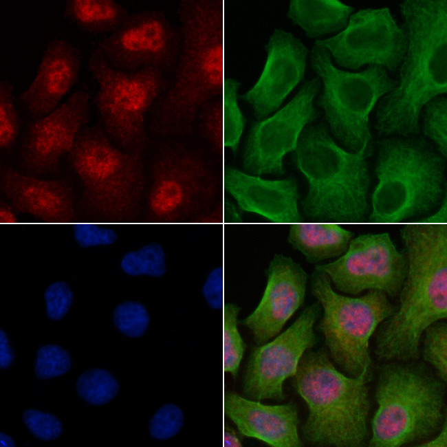 CENPN Antibody in Immunocytochemistry (ICC/IF)
