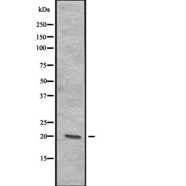 ITGB3BP Antibody in Western Blot (WB)