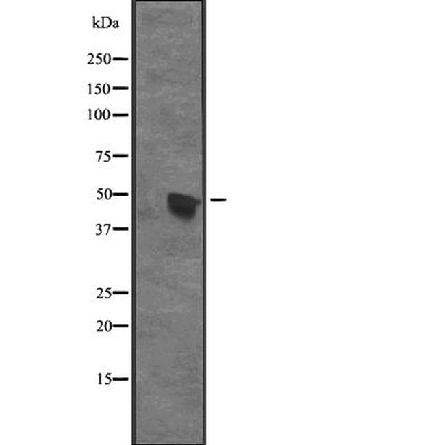 CENPU Antibody in Western Blot (WB)