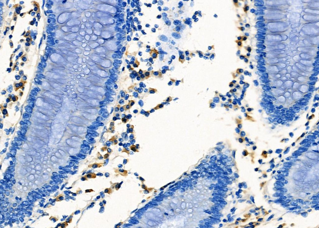 CXCR5 Antibody in Immunohistochemistry (Paraffin) (IHC (P))