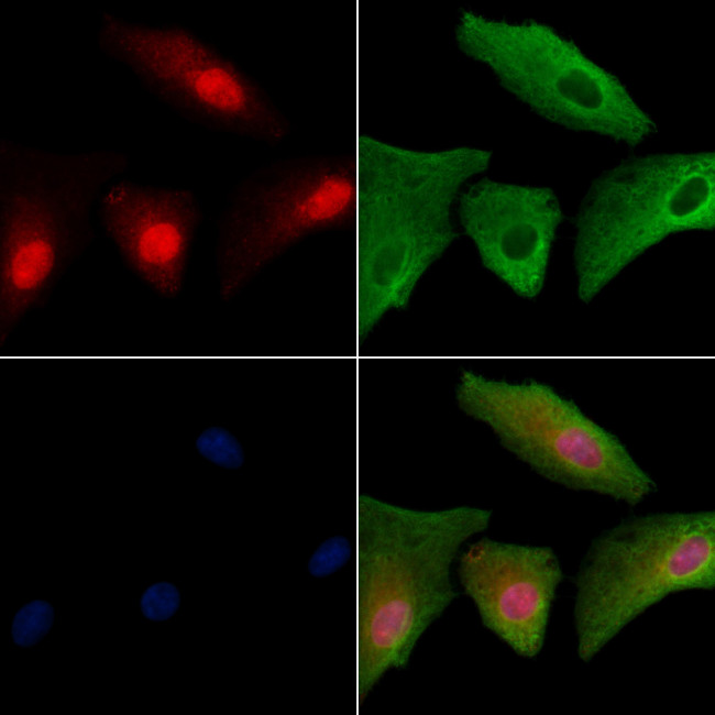 FAM58A Antibody in Immunocytochemistry (ICC/IF)