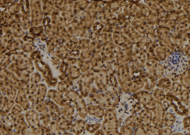RAD9B Antibody in Immunohistochemistry (Paraffin) (IHC (P))