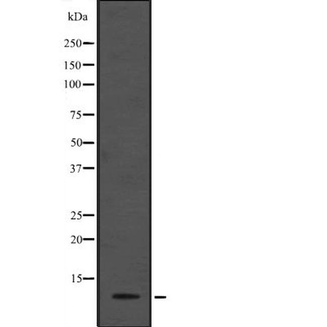 APC13 Antibody in Western Blot (WB)