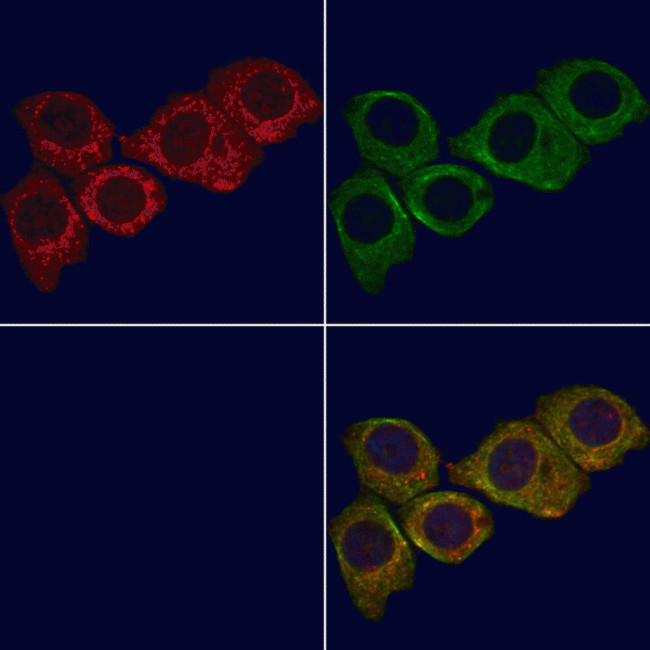 MT-CYB Antibody in Immunocytochemistry (ICC/IF)