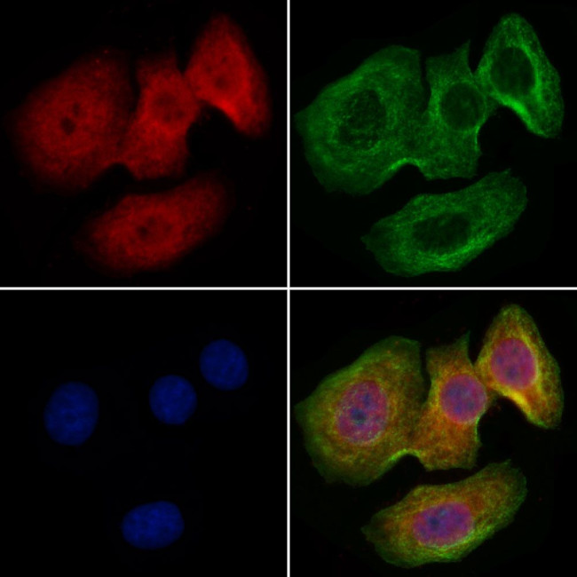 VPARP Antibody in Immunocytochemistry (ICC/IF)