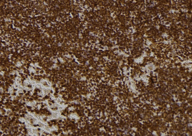 PMS1 Antibody in Immunohistochemistry (Paraffin) (IHC (P))