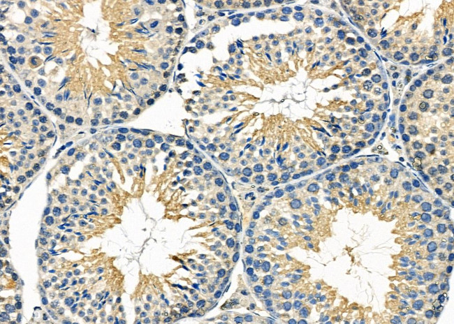 SPINK7 Antibody in Immunohistochemistry (Paraffin) (IHC (P))