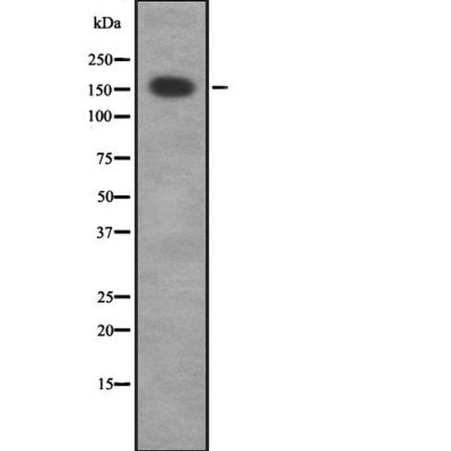 MRCK gamma Antibody in Western Blot (WB)
