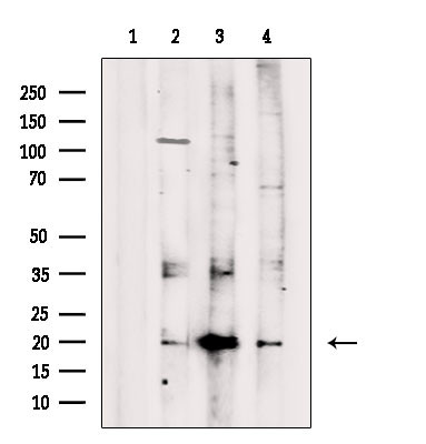 GKN2 Antibody in Western Blot (WB)