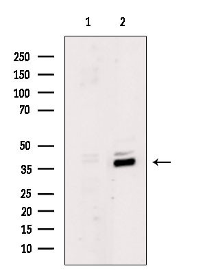 MKX Antibody in Western Blot (WB)