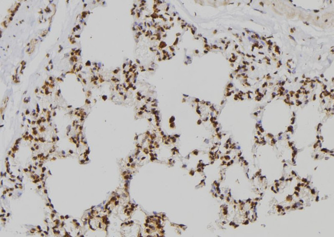 ZNF440 Antibody in Immunohistochemistry (Paraffin) (IHC (P))