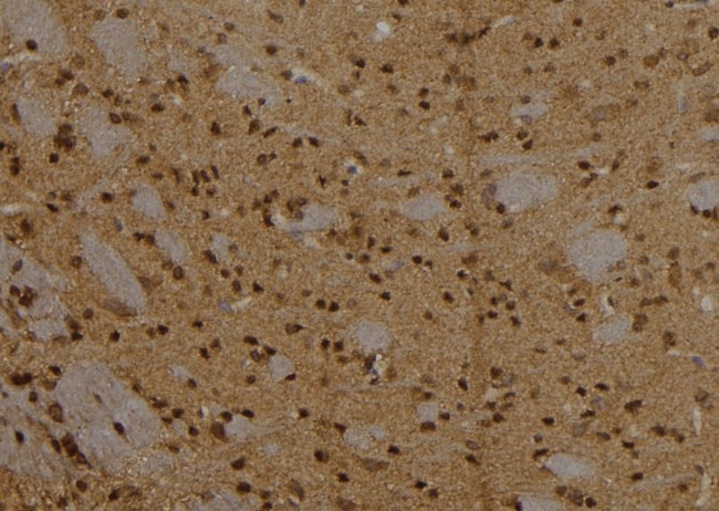 CPXCR1 Antibody in Immunohistochemistry (Paraffin) (IHC (P))
