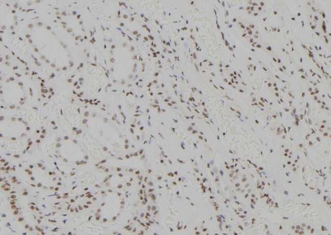 ZNF713 Antibody in Immunohistochemistry (Paraffin) (IHC (P))