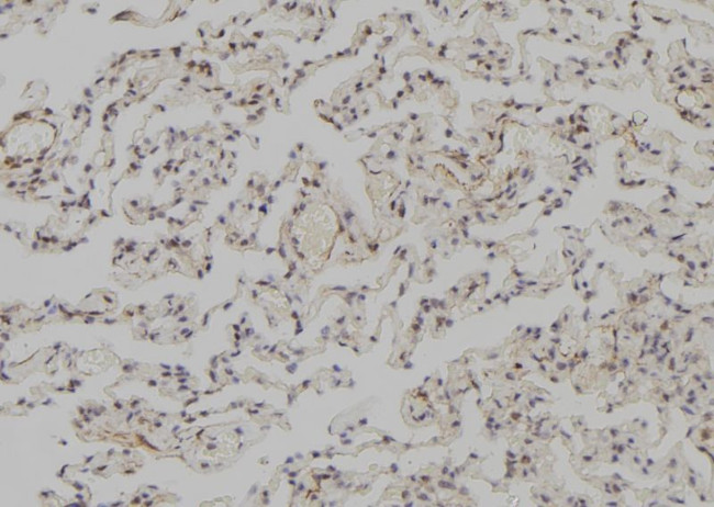 SNAPC3 Antibody in Immunohistochemistry (Paraffin) (IHC (P))