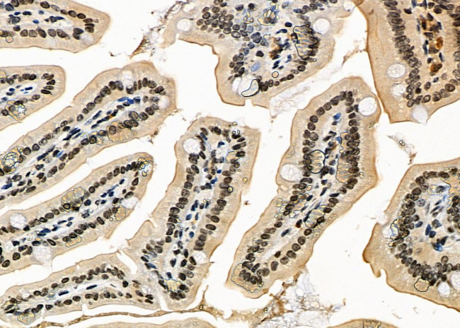 DIRC1 Antibody in Immunohistochemistry (Paraffin) (IHC (P))