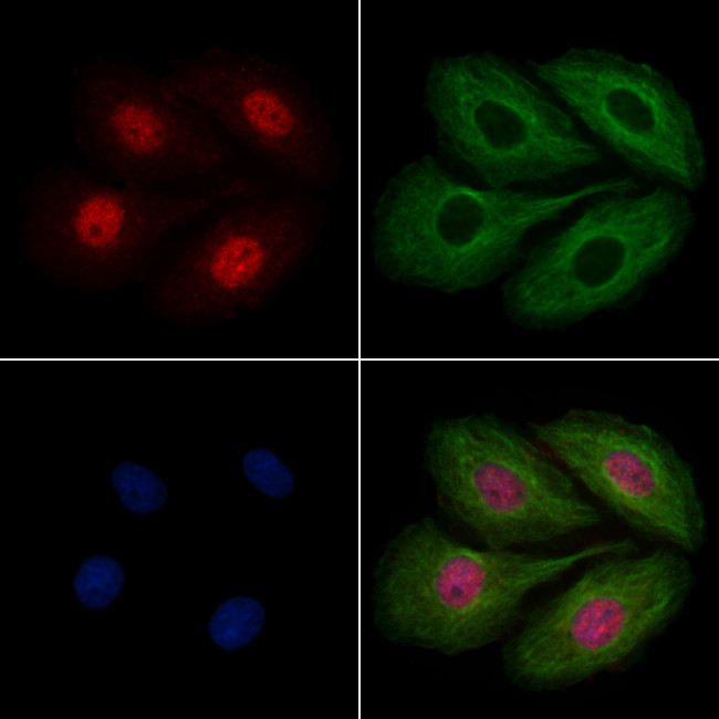 HEXIM2 Antibody in Immunocytochemistry (ICC/IF)