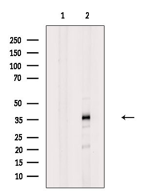 hnRNP AB Antibody in Western Blot (WB)