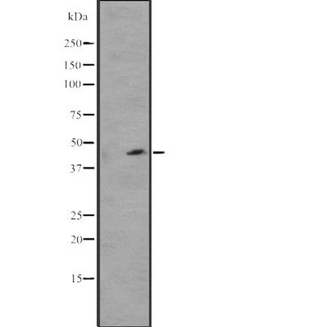 WWTR1 Antibody in Western Blot (WB)