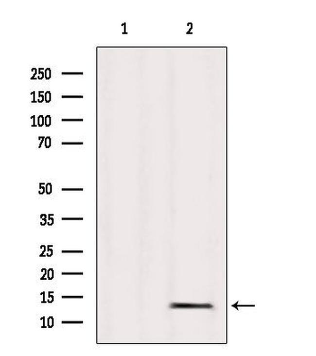 MRPL36 Antibody in Western Blot (WB)