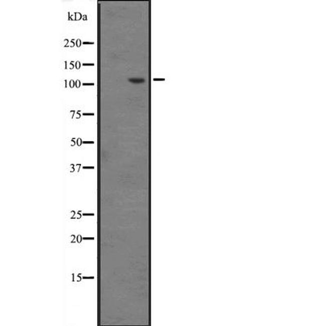 INTS6 Antibody in Western Blot (WB)