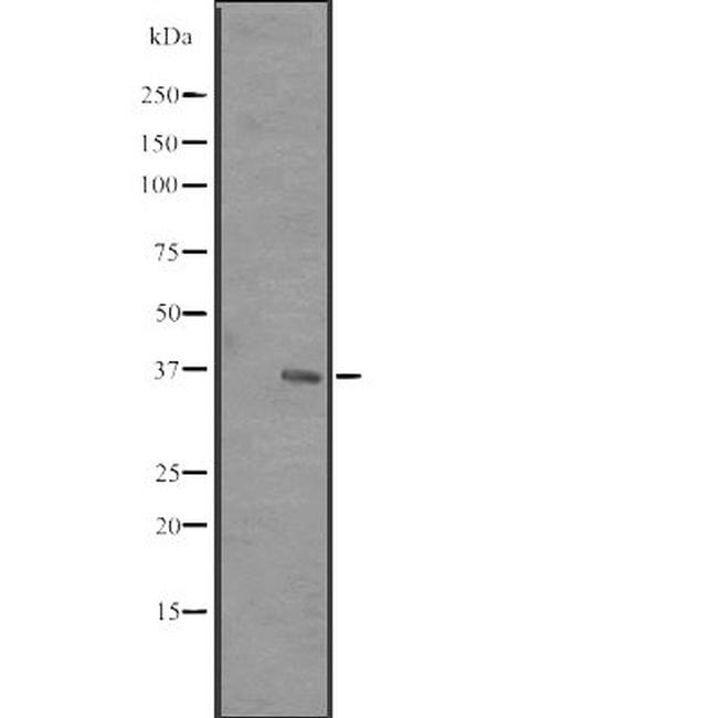RRP7A Antibody in Western Blot (WB)